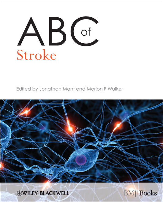 ABC of Stroke (Paperback / softback) 9781405167901