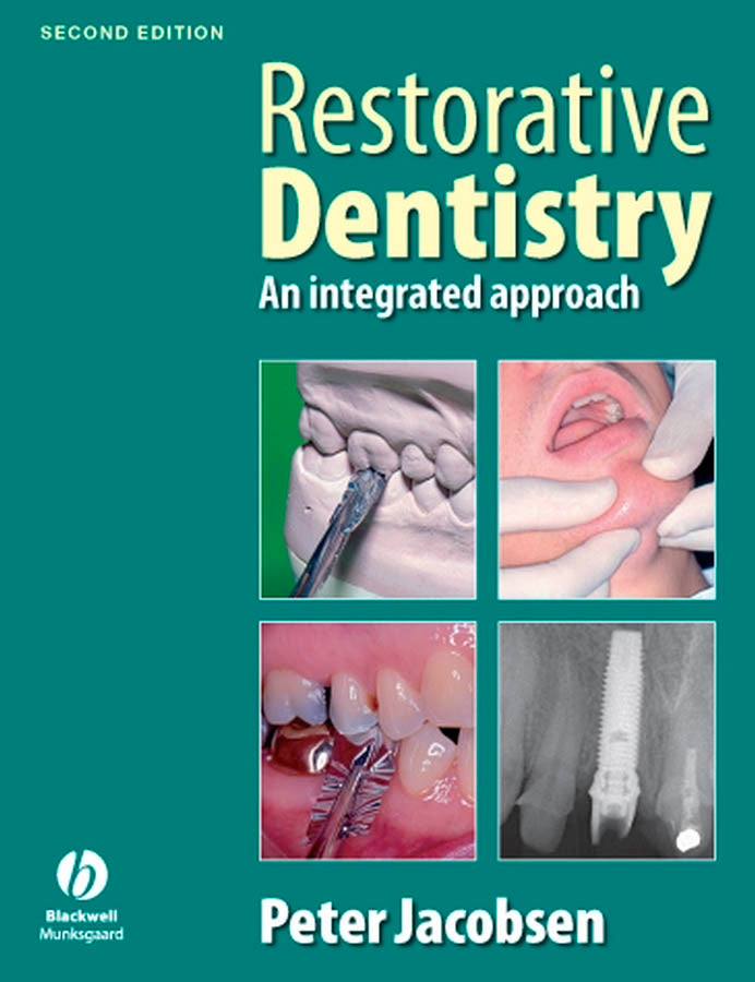 Restorative Dentistry 2e (Paperback / softback) 9781405167994