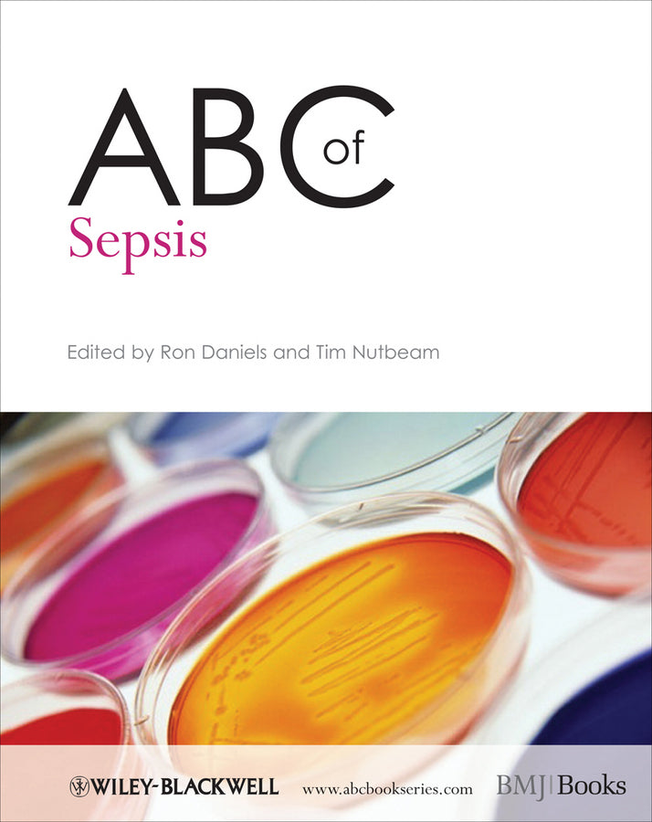 ABC of Sepsis (Paperback / softback) 9781405181945