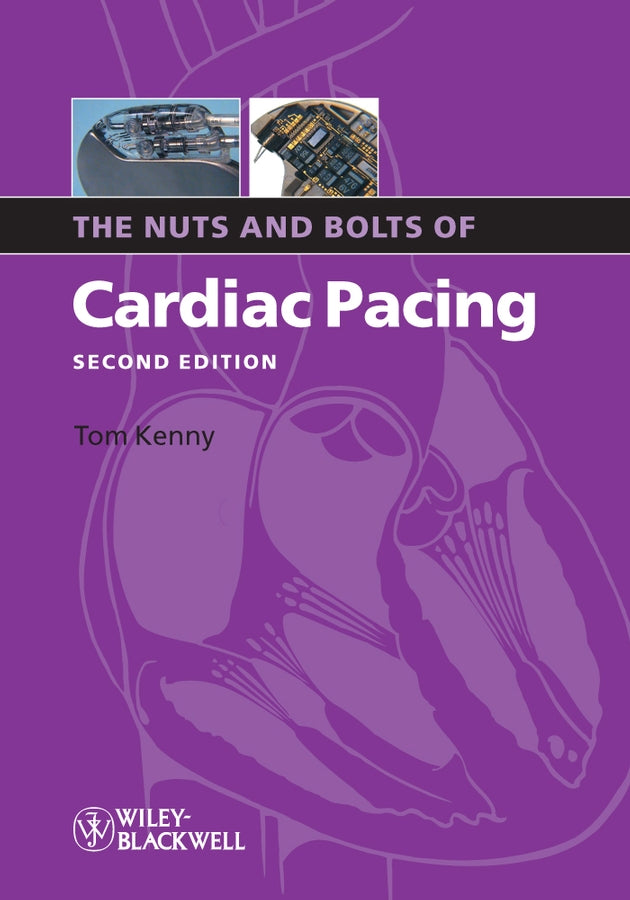 The Nuts and Bolts of Cardiac Pacing 2e (Paperback / softback) 9781405184038