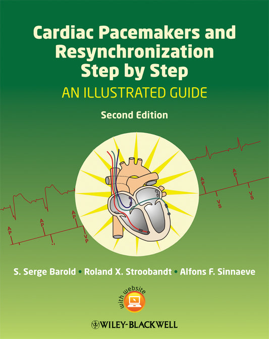 Cardiac Pacemakers and Resynchronization Step by Step – An Illustrated Guide 2e (Paperback / softback) 9781405186360