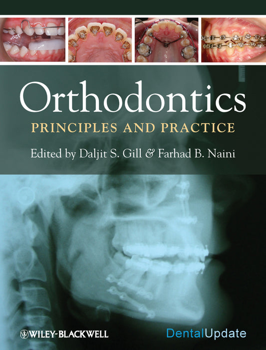 Orthodontics – Principles and Practice (Hardback) 9781405187473