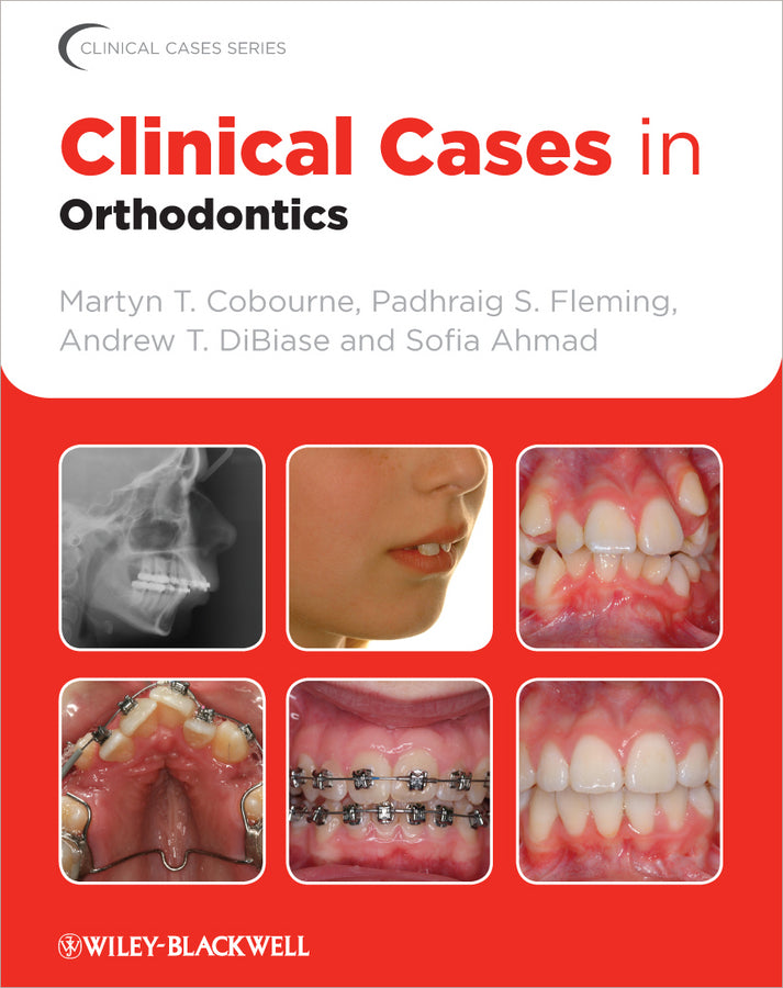 Clinical Cases in Orthodontics (Paperback / softback) 9781405197793