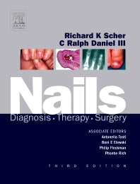 Nails; Diagnosis, Therapy, Surgery (Hardback) 9781416023562