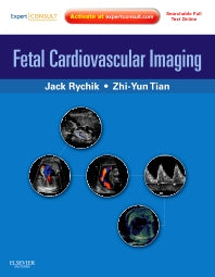 Fetal Cardiovascular Imaging: A Disease Based Approach; Expert Consult Premium Edition: Enhanced Online Features and Print (Hardback) 9781416031727