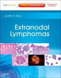 Extranodal Lymphomas; Expert Consult - Online and Print (Hardback) 9781416045793