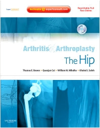 Arthritis and Arthroplasty: The Hip; Expert Consult - Online, Print and DVD (Hardback) 9781416049739