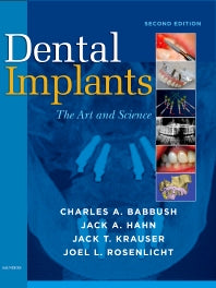 Dental Implants; The Art and Science (Hardback) 9781416053415