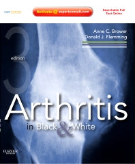 Arthritis in Black and White; Expert Consult - Online and Print (Hardback) 9781416055952