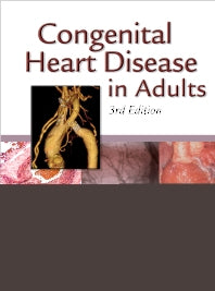 Congenital Heart Disease in Adults (Hardback) 9781416058946