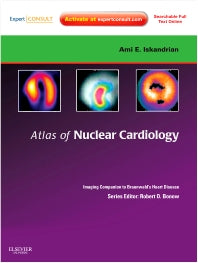 Atlas of Nuclear Cardiology: Imaging Companion to Braunwald's Heart Disease; Expert Consult - Online and Print (Hardback) 9781416061342