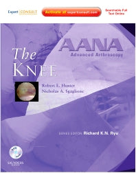 AANA Advanced Arthroscopy: The Knee; Expert Consult: Online, Print and DVD (Hardback) 9781437706642