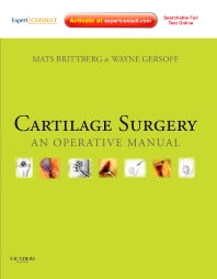 Cartilage Surgery; An Operative Manual, Expert Consult: Online and Print (Hardback) 9781437708783