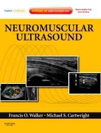 Neuromuscular Ultrasound; Expert Consult - Online and Print (Hardback) 9781437715279