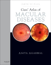 Gass' Atlas of Macular Diseases; 2-Volume Set - Expert Consult: Online and Print (Hardback) 9781437715804