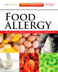 Food Allergy; Expert Consult Basic (Hardback) 9781437719925