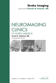 Stroke Imaging, An Issue of Neuroimaging Clinics (Hardback) 9781437726930