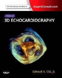 Atlas of 3D Echocardiography; Expert Consult – Online and Print (Hardback) 9781437726992