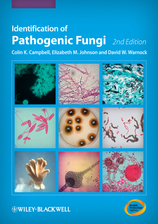 Identification of Pathogenic Fungi 2e (Hardback) 9781444330700