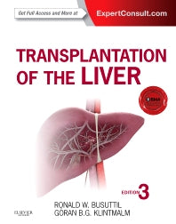 Transplantation of the Liver (Hardback) 9781455702688