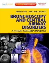 Bronchoscopy and Central Airway Disorders; A Patient-Centered Approach: Expert Consult Online and Print (Hardback) 9781455703203