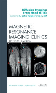 Clinical Applications of Diffusion Imaging: from Head to Toe, An Issue of Magnetic Resonance Imaging Clinics (Hardback) 9781455704668