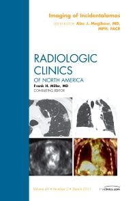 Imaging of Incidentalomas, An Issue of Radiologic Clinics of North America (Hardback) 9781455705016