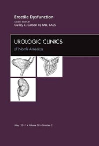 Erectile Dysfunction, An Issue of Urologic Clinics (Hardback) 9781455705177