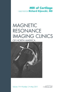 MRI of Cartilage, An Issue of Magnetic Resonance Imaging Clinics (Hardback) 9781455707423