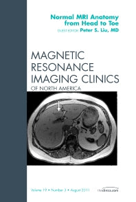 Normal MR Anatomy from Head to Toe, An Issue of Magnetic Resonance Imaging Clinics (Hardback) 9781455710355