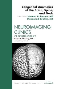 Congenital Anomalies of the Brain, Spine, and Neck, An Issue of Neuroimaging Clinics (Hardback) 9781455711109