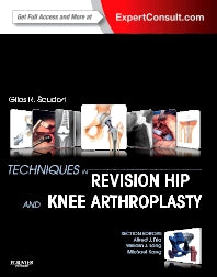 Techniques in Revision Hip and Knee Arthroplasty (Hardback) 9781455723683