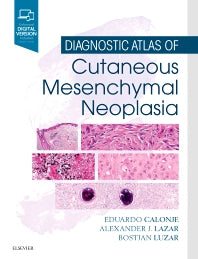 Diagnostic Atlas of Cutaneous Mesenchymal Neoplasia (Hardback) 9781455725014