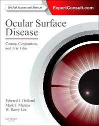 Ocular Surface Disease: Cornea, Conjunctiva and Tear Film; Expert Consult - Online and Print (Hardback) 9781455728763