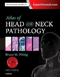 Atlas of Head and Neck Pathology (Hardback) 9781455733828
