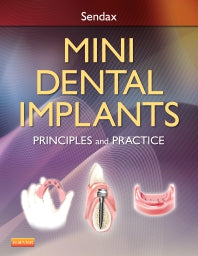 Mini Dental Implants; Principles and Practice (Hardback) 9781455743865