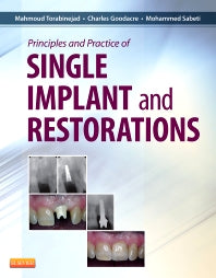 Principles and Practice of Single Implant and Restoration (Hardback) 9781455744763