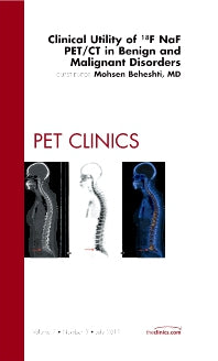 Clinical Utility of 18NaF PET/CT in Benign and Malignant Disorders, An Issue of PET Clinics (Hardback) 9781455748860