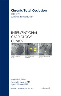 Chronic Total Occlusion, An issue of Interventional Cardiology Clinics (Hardback) 9781455748938