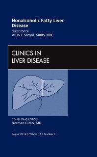 Nonalcoholic Fatty Liver Disease, An Issue of Clinics in Liver Disease (Hardback) 9781455749164