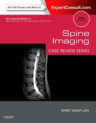 Spine Imaging: Case Review Series; Expert Consult - Online and Print (Paperback / softback) 9781455751167