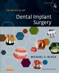 Color Atlas of Dental Implant Surgery (Hardback) 9781455759682