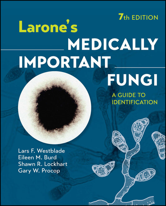 Larone?s Medically Important Fungi: A Guide to Ide ntification, 7th Edition (Hardback) 9781683674405