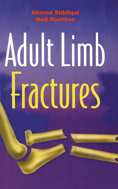 Adult Limb Fractures (Paperback / softback) 9781841100784