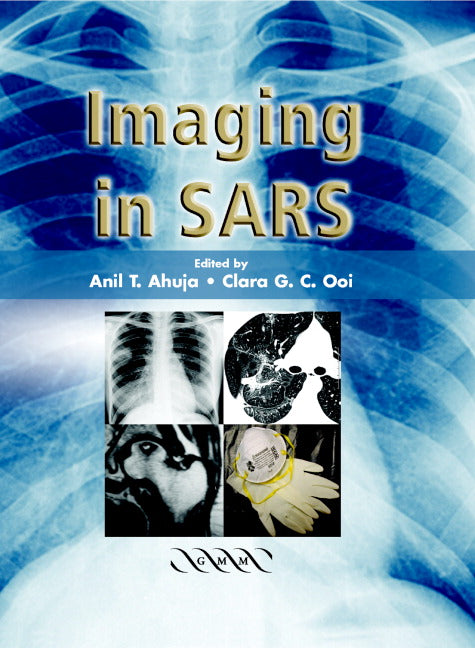 Imaging in SARS (Hardback) 9781841102191