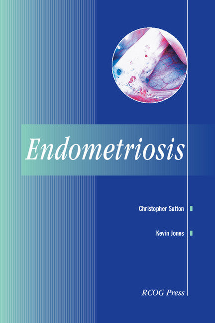 Endometriosis (Paperback / softback) 9781900364874