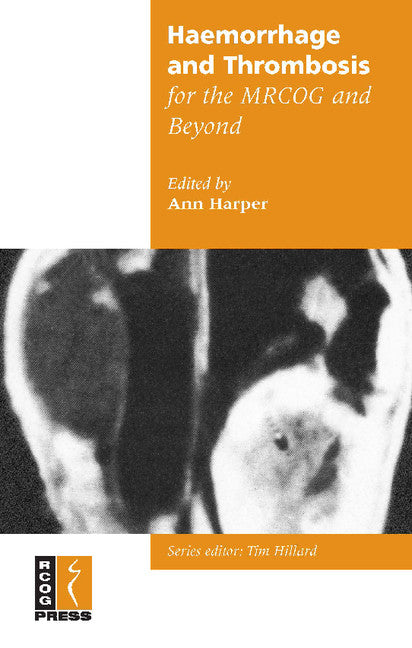 Haemorrhage and Thrombosis for the MRCOG and Beyond (Paperback / softback) 9781900364966