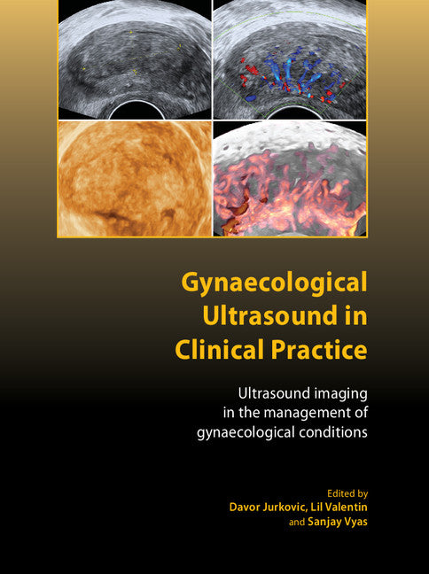 Gynaecological Ultrasound in Clinical Practice; Ultrasound Imaging in the Management of Gynaecological Conditions (Hardback) 9781904752295