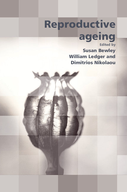 Reproductive Ageing (Paperback / softback) 9781906985134