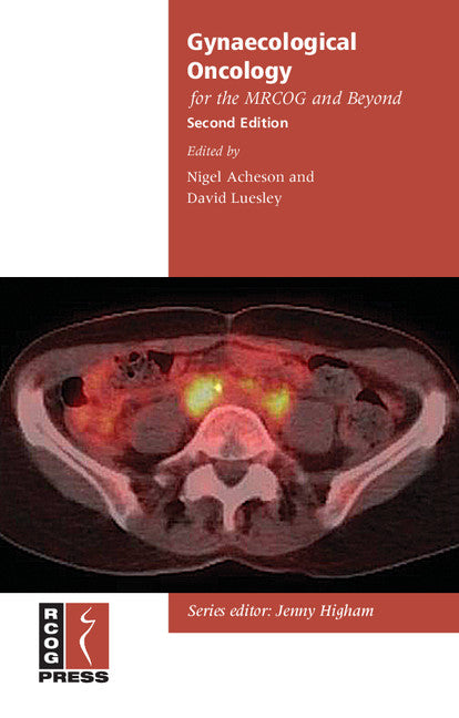 Gynaecological Oncology for the MRCOG and Beyond (Paperback / softback) 9781906985219